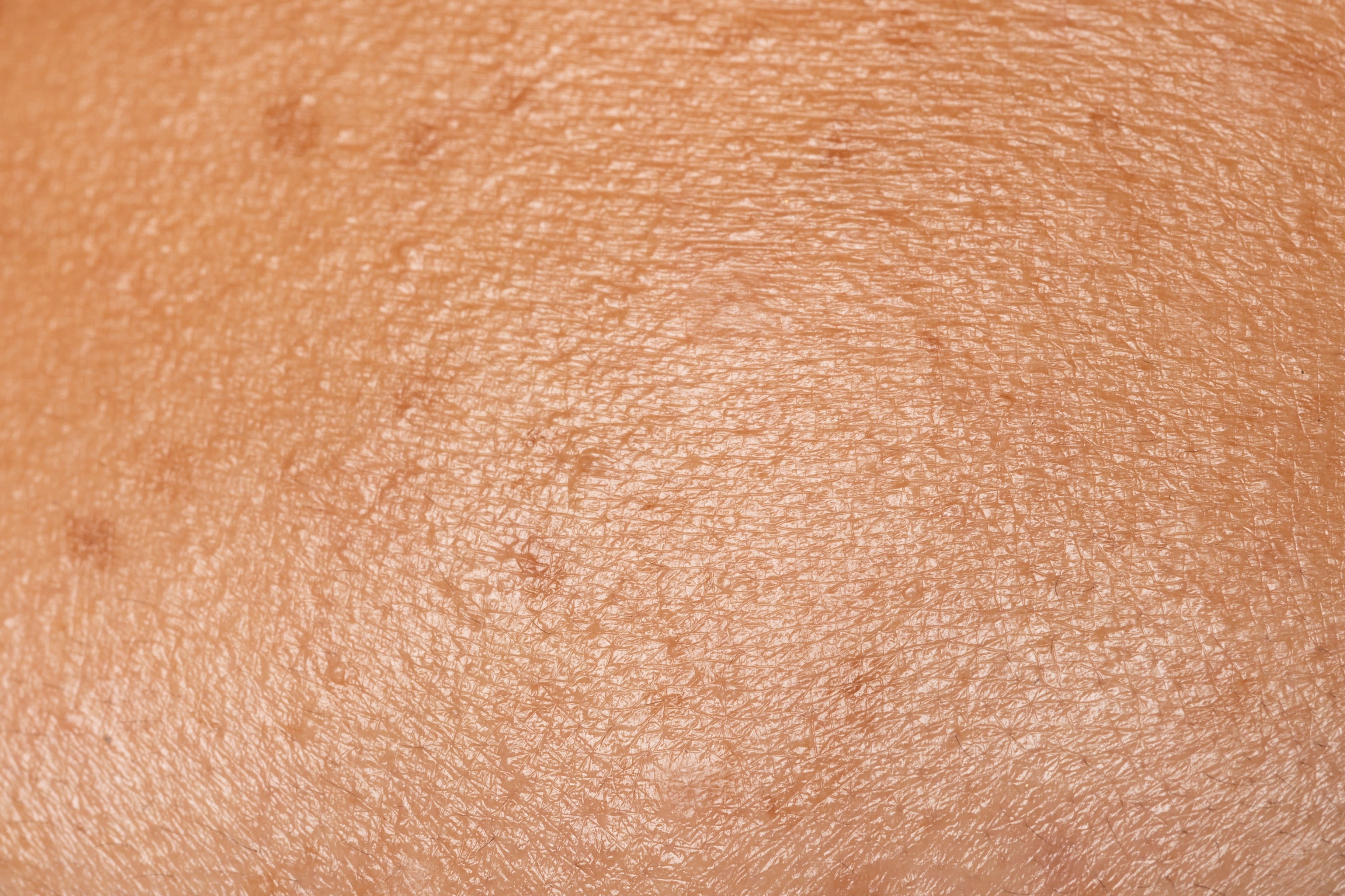 Moisturize your dry skin with ampm